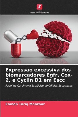 bokomslag Expressão excessiva dos biomarcadores Egfr, Cox-2, e Cyclin D1 em Escc