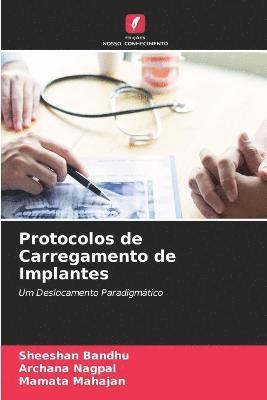 Protocolos de Carregamento de Implantes 1