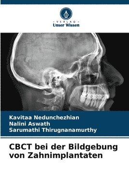 bokomslag CBCT bei der Bildgebung von Zahnimplantaten