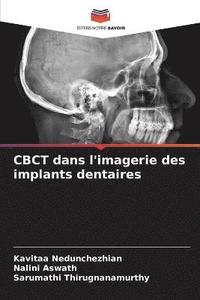 bokomslag CBCT dans l'imagerie des implants dentaires