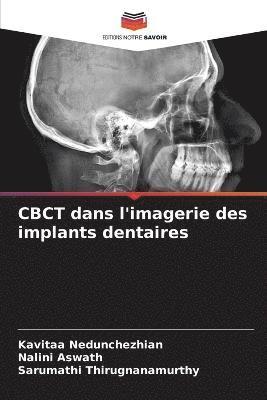 CBCT dans l'imagerie des implants dentaires 1