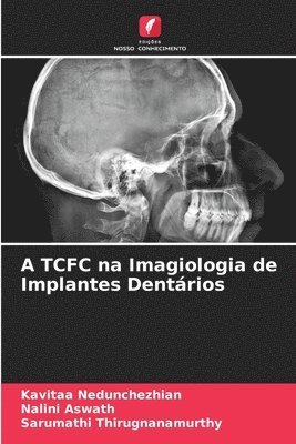 A TCFC na Imagiologia de Implantes Dentrios 1