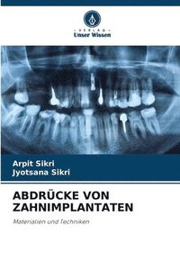 bokomslag Abdrcke Von Zahnimplantaten