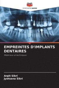 bokomslag Empreintes d'Implants Dentaires