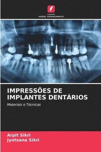 bokomslag Impresses de Implantes Dentrios