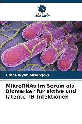 MikroRNAs im Serum als Biomarker fr aktive und latente TB-Infektionen 1