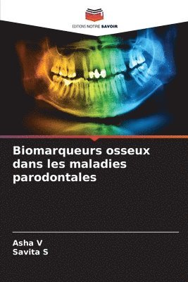 Biomarqueurs osseux dans les maladies parodontales 1