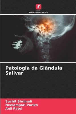 Patologia da Glndula Salivar 1