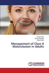 bokomslag Management of Class II Malocclusion in Adults