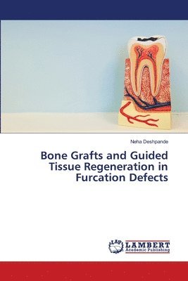 bokomslag Bone Grafts and Guided Tissue Regeneration in Furcation Defects