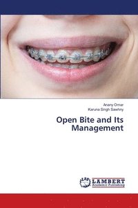 bokomslag Open Bite and Its Management