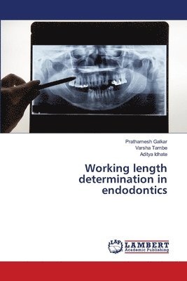 Working length determination in endodontics 1