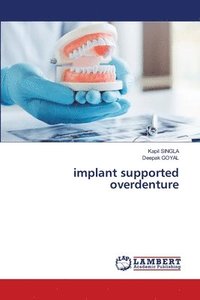 bokomslag implant supported overdenture