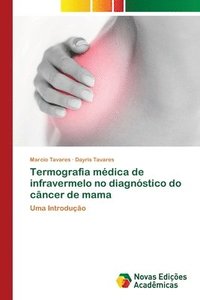 bokomslag Termografia medica de infravermelo no diagnostico do cancer de mama