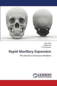 bokomslag Rapid Maxillary Expansion