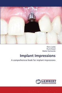 bokomslag Implant Impressions