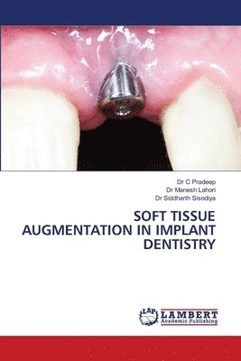 Soft Tissue Augmentation in Implant Dentistry 1