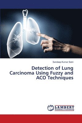 bokomslag Detection of Lung Carcinoma Using Fuzzy and ACO Techniques