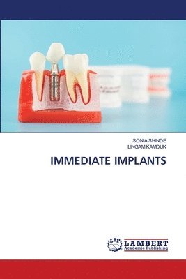 bokomslag Immediate Implants