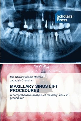 Maxillary Sinus Lift Procedures 1