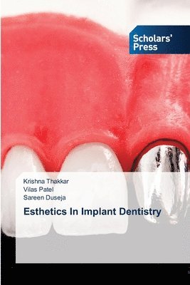 Esthetics In Implant Dentistry 1