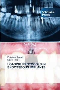 bokomslag Loading Protocols in Endosseous Implants