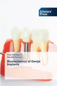 bokomslag Biomechanics of Dental Implants