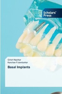 bokomslag Basal Implants