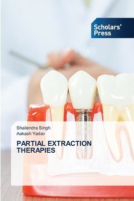 Partial Extraction Therapies 1