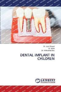 bokomslag Dental Implant in Children