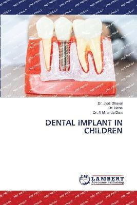 Dental Implant in Children 1
