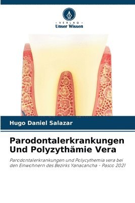 Parodontalerkrankungen Und Polyzythmie Vera 1