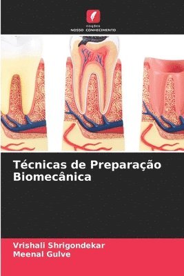 Tcnicas de Preparao Biomecnica 1