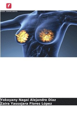 Epigentica do cancro da mama 1