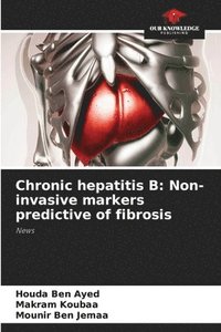 bokomslag Chronic hepatitis B