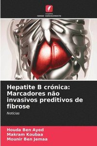 bokomslag Hepatite B crnica