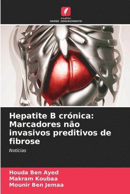 Hepatite B crnica 1
