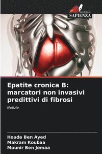 bokomslag Epatite cronica B