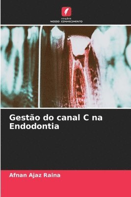 Gesto do canal C na Endodontia 1