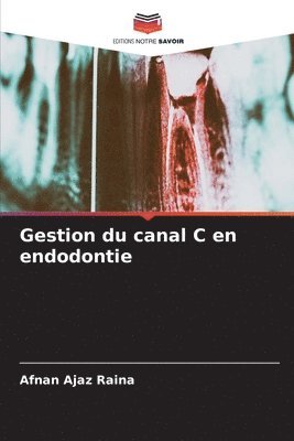 Gestion du canal C en endodontie 1
