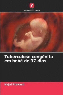 Tuberculose congnita em beb de 37 dias 1