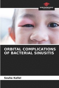 bokomslag Orbital Complications of Bacterial Sinusitis