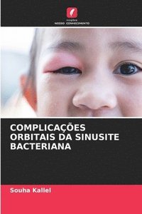 bokomslag Complicaes Orbitais Da Sinusite Bacteriana