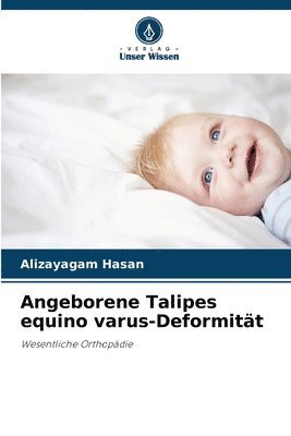 Angeborene Talipes equino varus-Deformitt 1