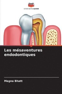 bokomslag Les msaventures endodontiques