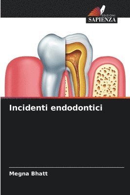 Incidenti endodontici 1