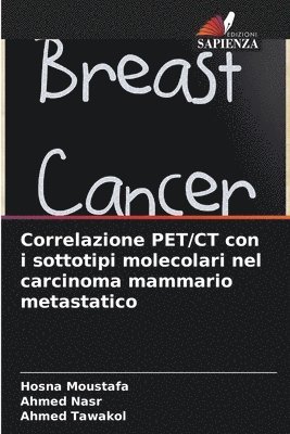 Correlazione PET/CT con i sottotipi molecolari nel carcinoma mammario metastatico 1