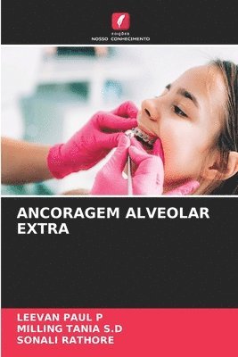 Ancoragem Alveolar Extra 1