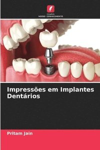 bokomslag Impresses em Implantes Dentrios