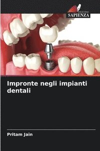 bokomslag Impronte negli impianti dentali